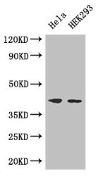 Anti-ACTG1 / Actin gamma 1 Antibody