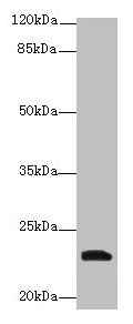 Anti-YKT6 Antibody