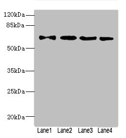 Anti-ZNF324 Antibody