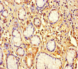 Anti-ZNF627 Antibody