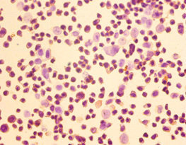 Anti-HOMER1 Antibody