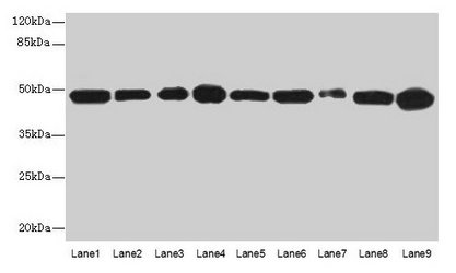 Anti-GOT2 Antibody