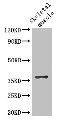 Anti-DNAJB6 Antibody