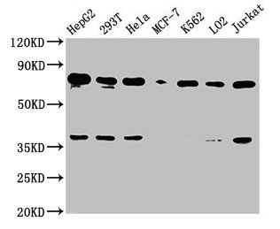 Anti-UBC Antibody