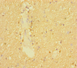 Anti-SLC6A7 Antibody