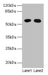 Anti-GTPBP6 Antibody