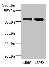 Anti-EFCAB14 Antibody