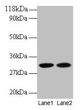 Anti-MRPL9 Antibody