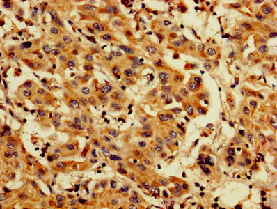 Anti-PDCD6 Antibody