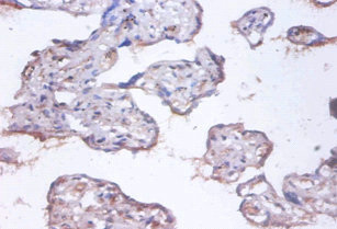 Anti-COMMD4 Antibody