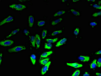 Anti-LYPLA2 Antibody