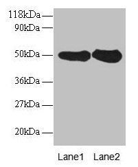 Anti-RPN1 Antibody