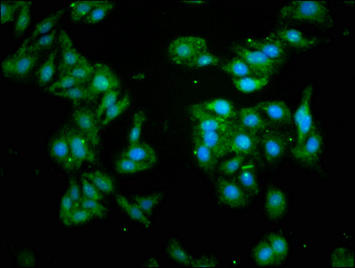 Anti-GABARAP Antibody
