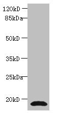 Anti-CST3 Antibody