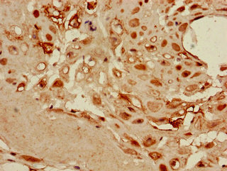 Anti-DKK1 Antibody