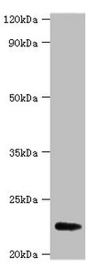 Anti-FGF21 Antibody