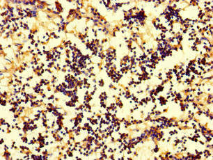 Anti-IL17A Antibody