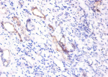 Anti-SPP1 Antibody