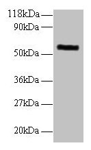 Anti-MMP1 Antibody