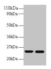 Anti-RBP4 Antibody
