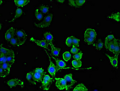 Anti-KIT / CD117 Antibody