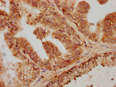 Anti-TGFB1 Antibody