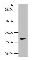 Anti-TGFB2 Antibody