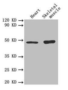 Anti-TGFB2 Antibody