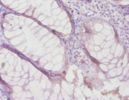 Anti-TIMP4 Antibody