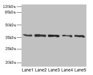 Anti-PLAUR Antibody