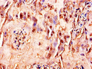 Anti-FLT4 Antibody