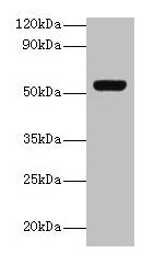 Anti-GC Antibody