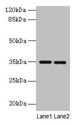 Anti-Thpo Antibody