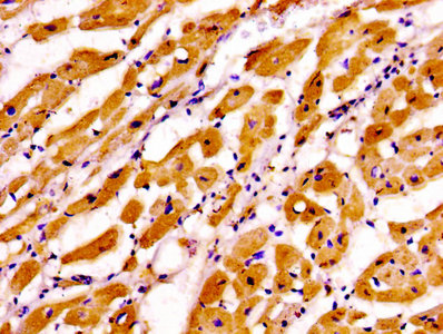Anti-TNNI3 Antibody