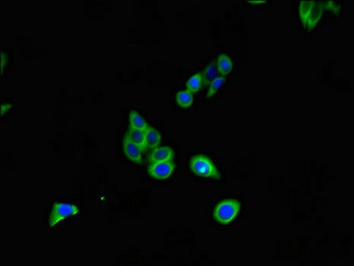 Anti-CD70 Antibody