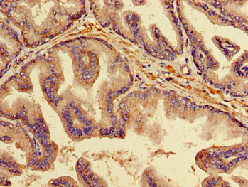 Anti-TNFRSF11B Antibody