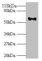 Anti-L1 Antibody