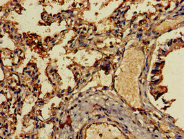 Anti-CCL13 Antibody