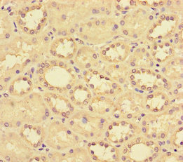Anti-CCL14 Antibody