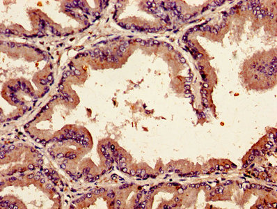 Anti-BMP2 / Bone morphogenetic protein 2 Antibody