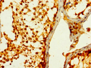 Anti-STC1 Antibody
