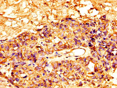 Anti-MSLN Antibody