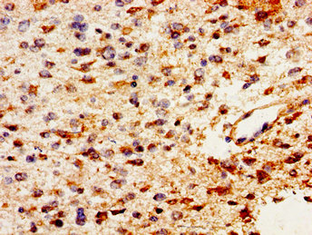 Anti-PTN Antibody