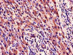 Anti-CYR61 Antibody