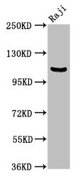 Anti-NFKB1 Antibody