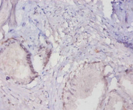 Anti-MUC16 Antibody