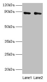 Anti-CFB Antibody