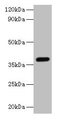 Anti-LRG1 Antibody
