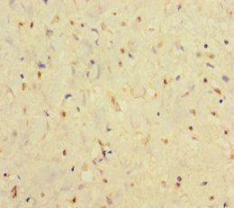 Anti-IFNAR2 Antibody