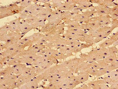 Anti-COL4A1 Antibody